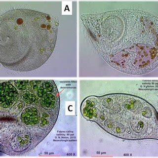  Heterotrichous Ciliate! These Tiny Beings Exhibit Remarkable Adaptations for Efficient Nutrient Absorption and Predatory Prowess.